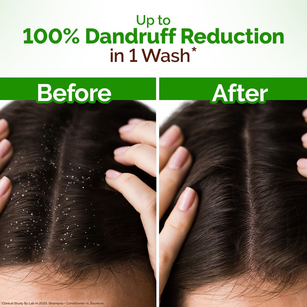 Lemon Anti-Dandruff Shampoo with Lemon & Aloe Vera for Itchy & Flaky Scalp - 250ml